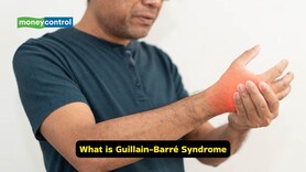 Guillain-Barré Syndrome: Causes, symptoms, and treatment options of this severe condition