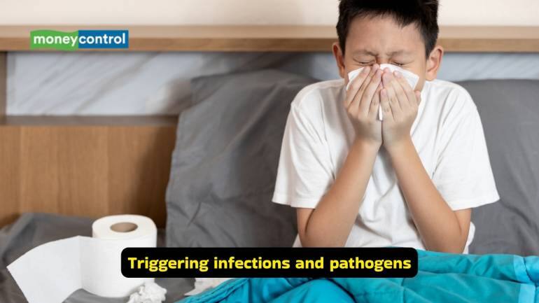 Guillain-Barré Syndrome causes, symptoms and treatment options (Image: Canva)