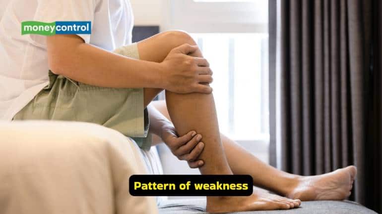 Guillain-Barré Syndrome causes, symptoms and treatment options (Image: Canva)