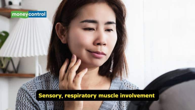 Guillain-Barré Syndrome causes, symptoms and treatment options (Image: Canva)