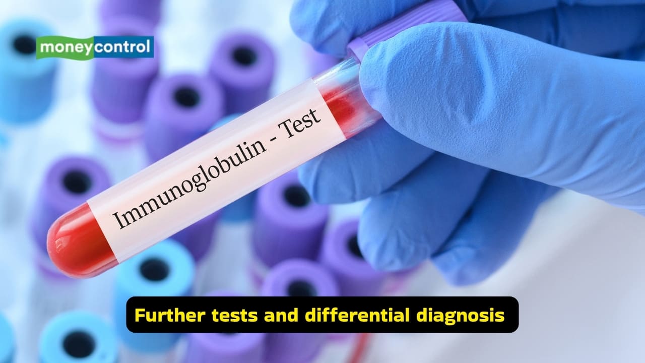 Guillain-Barré Syndrome causes, symptoms and treatment options (Image: Canva)