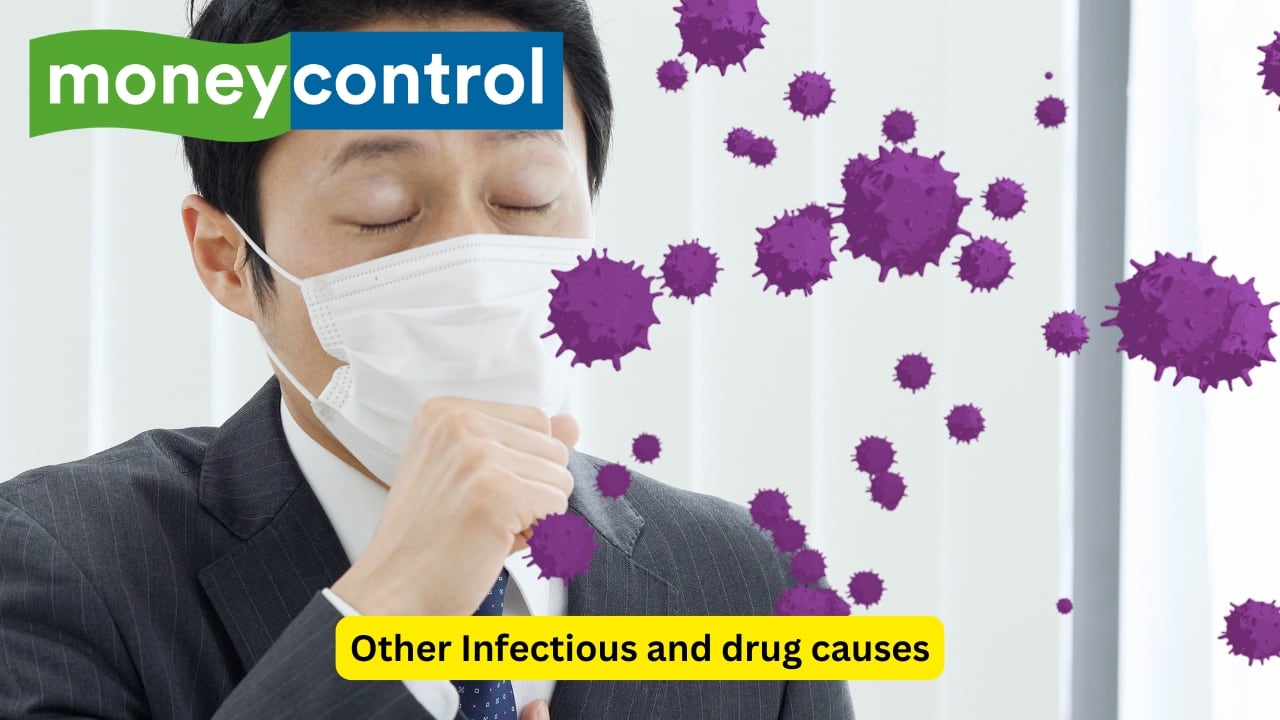 Other Infectious and drug causes However, bacteria may not be the only cause for gastritis. Other viral infections may also lead to a clinical presentation of chronic gastritis. Drug-induced gastritis is not uncommon either, and constant use of non-steroidal anti-inflammatory drugs (like aspirin), or other medications like corticosteroids can be a cause as well. (Image: Canva)