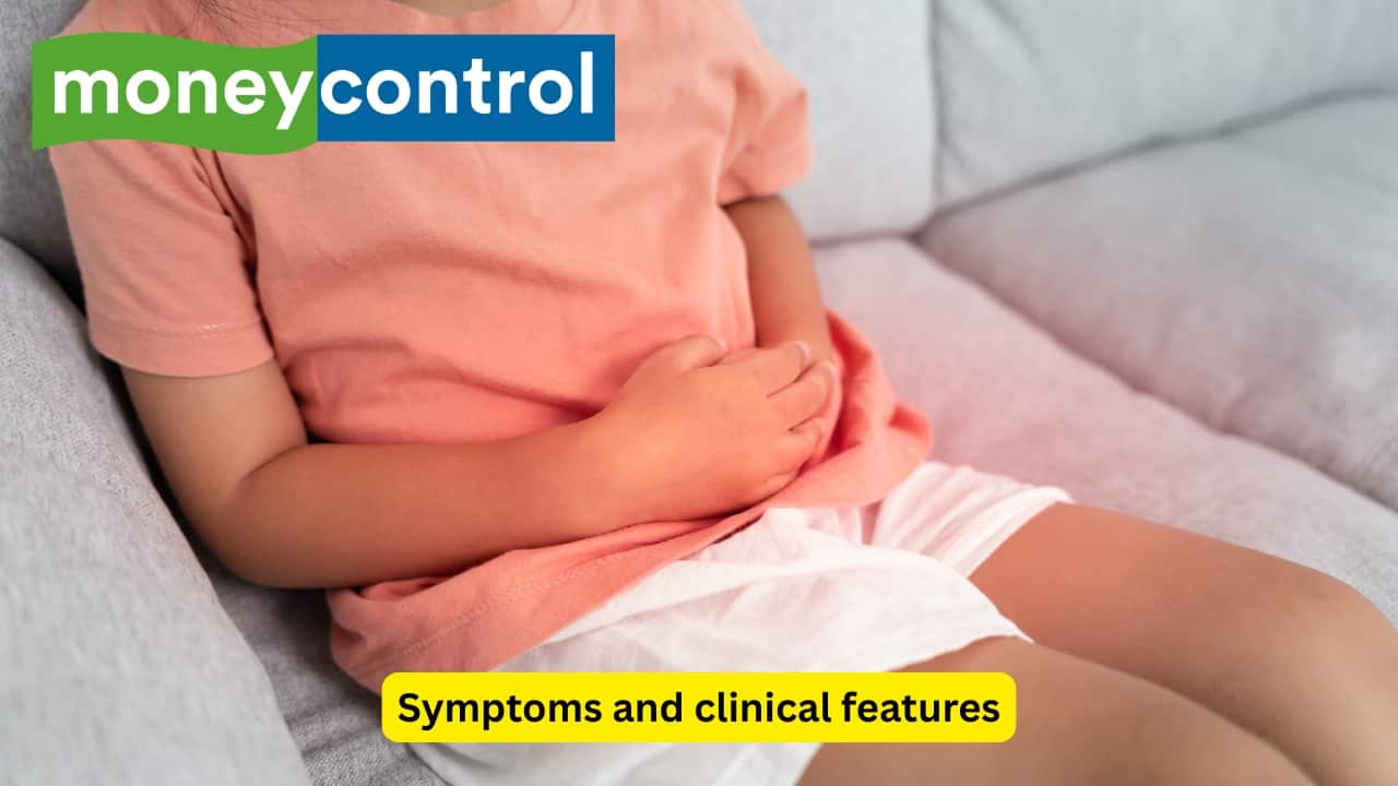 Symptoms and clinical features Inflammation of the stomach lining can lead to various symptoms, like pain in the abdomen (which may be mild or severe), nausea and vomiting, indigestion, as well as a feeling of being bloated. Some individuals may also experience a burning sensation in the upper part of the abdomen. (Image: Canva)