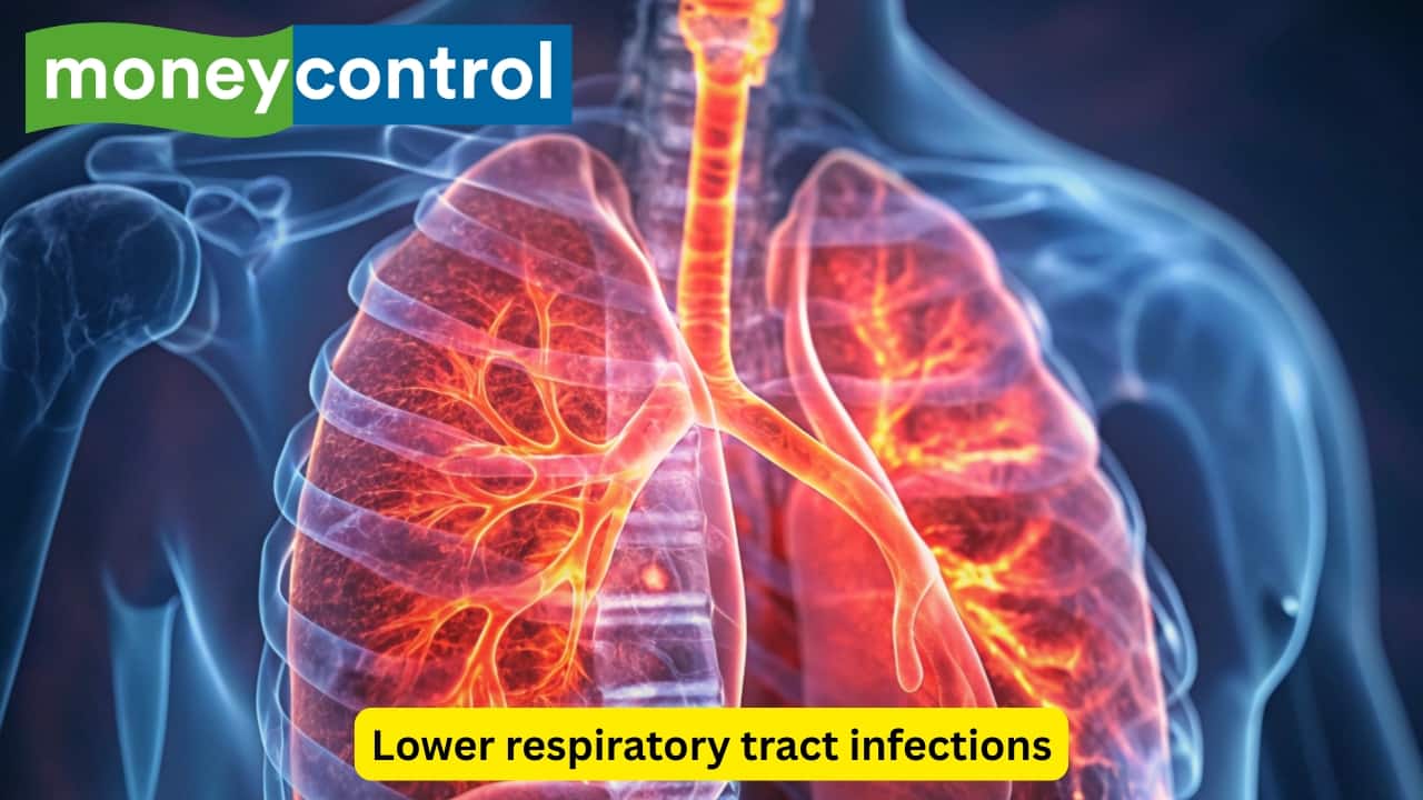 Lower respiratory tract infections There are many infections that affect the lower respiratory tract, which consists of the trachea, bronchi, bronchioles, and alveoli. The person often complains of fever with cough and difficulty in breathing, along with pain sensation in the chest. A chest X-ray with blood cultures usually points toward the diagnosis. (Image: Canva)