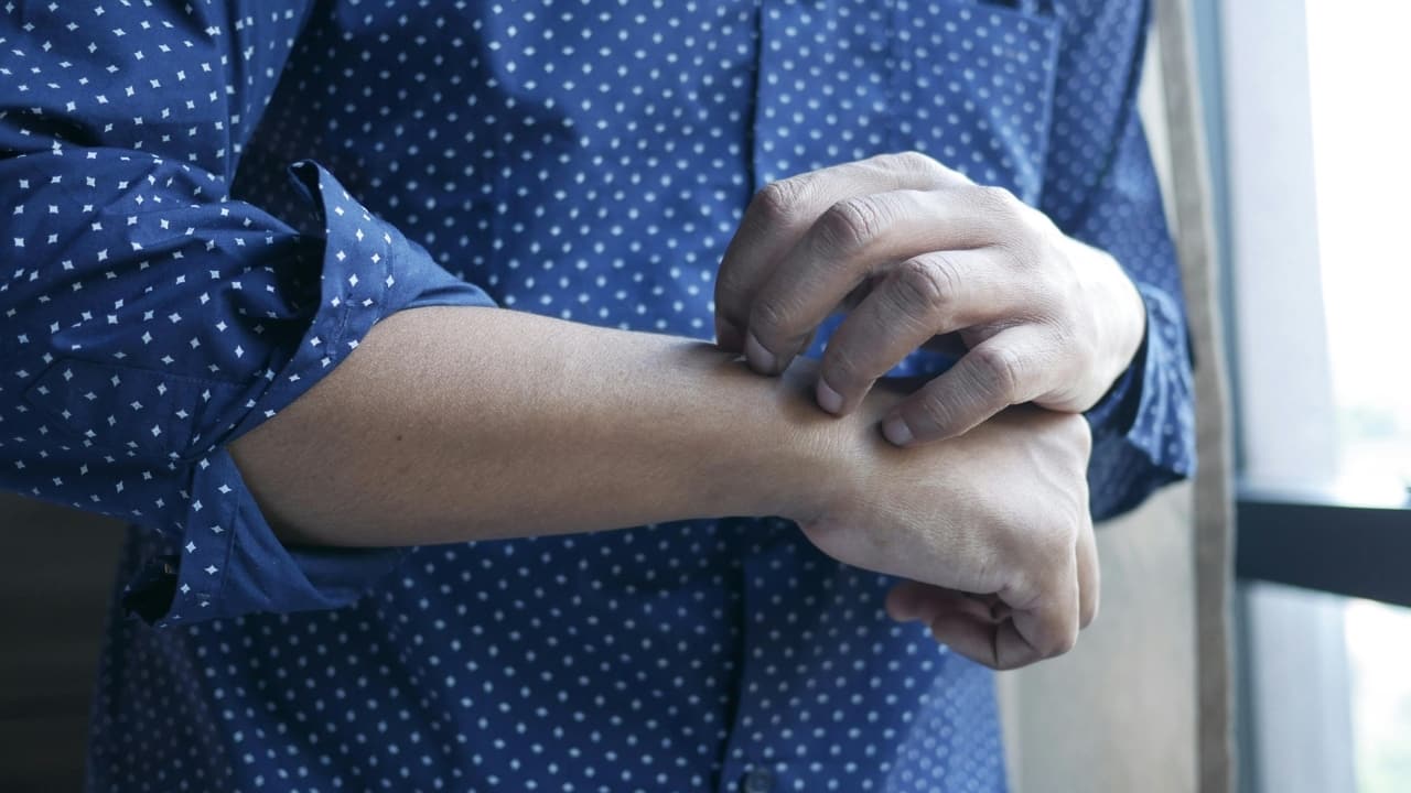 Top dermatologist lists causes of fungal skin infections after rains, suggests 5 tips to prevent it