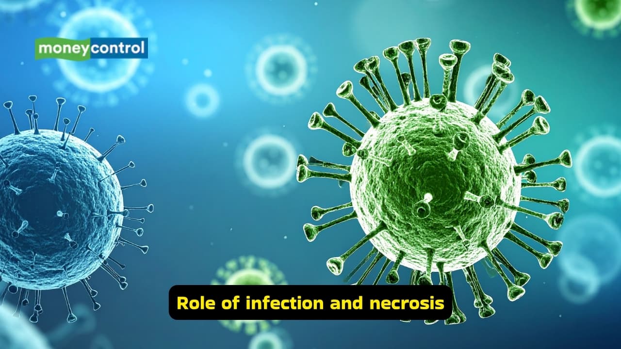 Symptoms of Diabetic Foot and causes (Images: Canva)