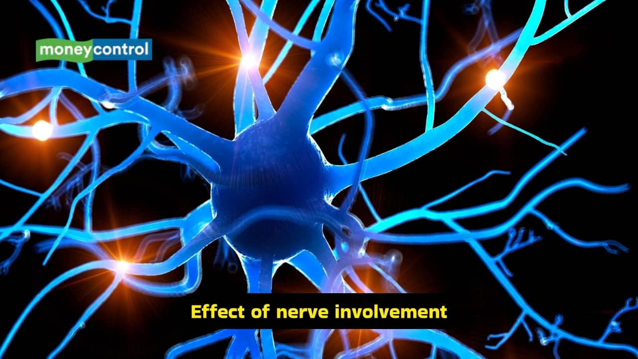 Symptoms of Diabetic Foot and causes (Images: Canva)