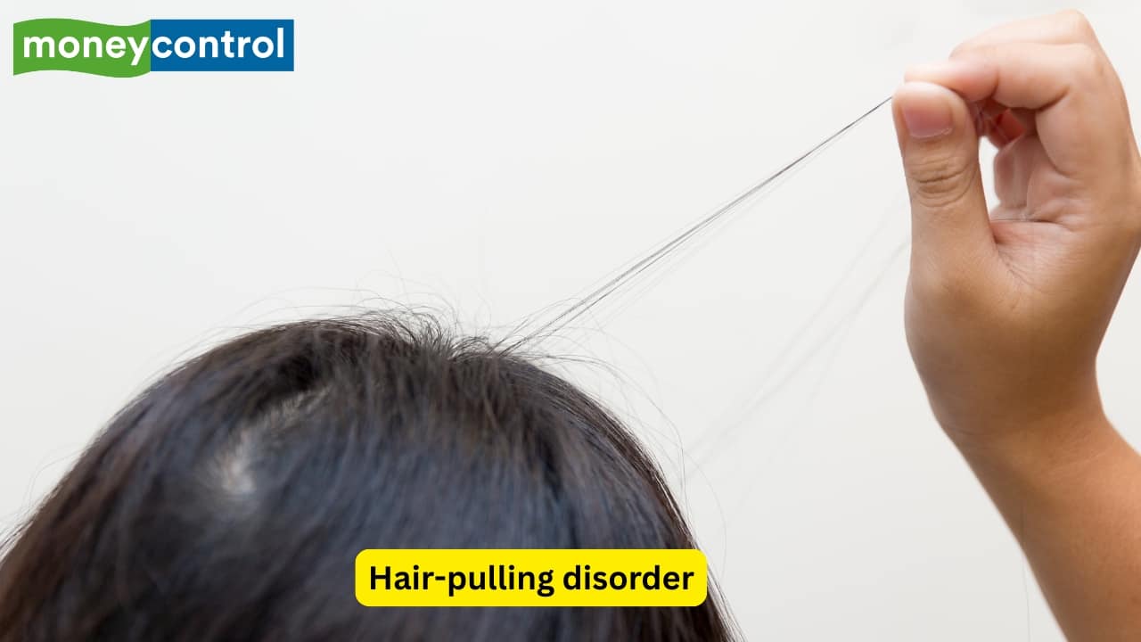 <strong>Trichotillomania or hair-pulling disorder</strong><br />Trichotillomania, also referred to as the hair-pulling disorder, that causes variable hair loss. The pulling out of hair is not for cosmetic reasons, but because the affected person has the irresistible urge to pull hair, especially during situations that can make them anxious.