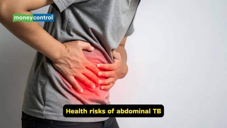Causes and symptoms of abdominal TB (Image: Canva)