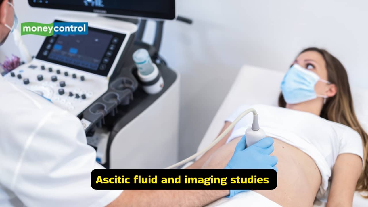 Causes and symptoms of abdominal TB (Image: Canva)