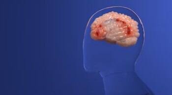 There are some glaring signs of a stroke that everyone should be able to identify