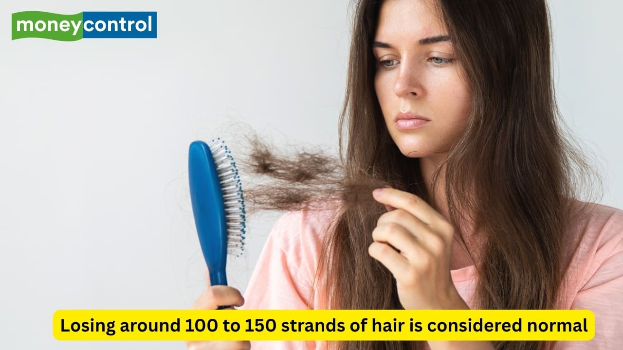 Is it normal to lose 150 strands of hair on a daily basis? This is what a dermatologist has to say