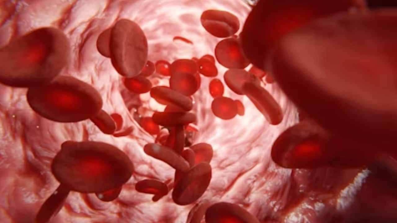 Senior doctor debunks myths about blood cancer; Check out how many did you think were true
