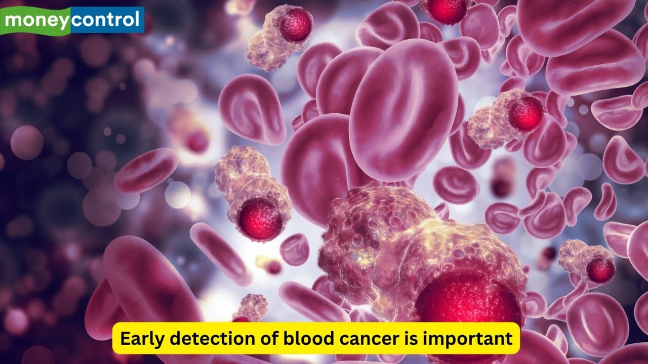 Haematologists share blood cancer symptoms that you should not ignore