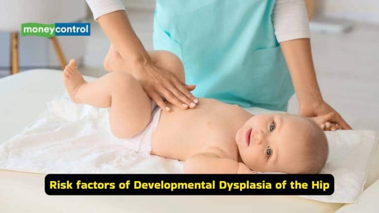 What is Developmental Dysplasia of the Hip (Image: Canva)