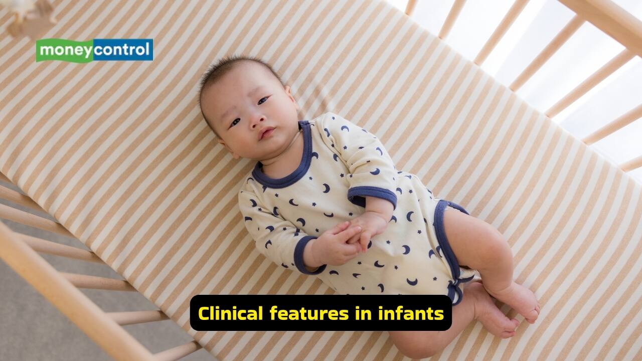 What is Developmental Dysplasia of the Hip (Image: Canva)