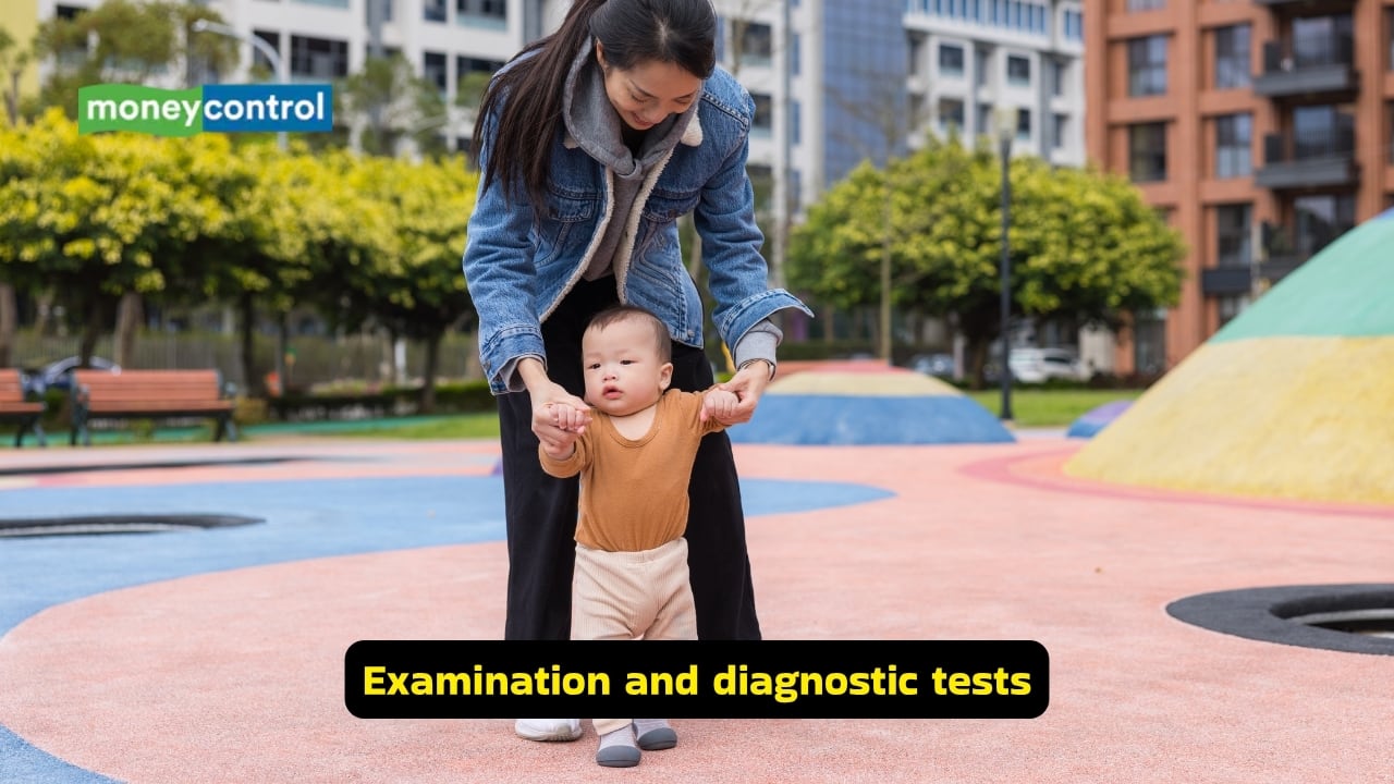 What is Developmental Dysplasia of the Hip (Image: Canva)