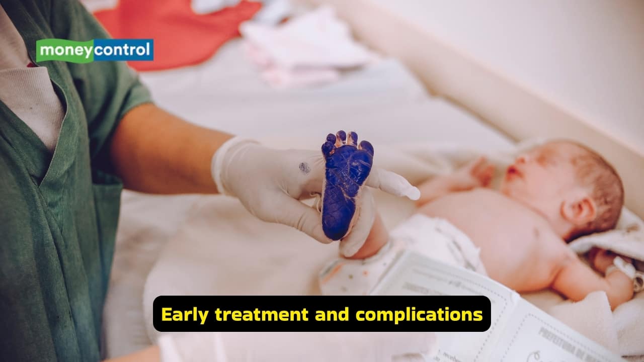 What is Developmental Dysplasia of the Hip (Image: Canva)