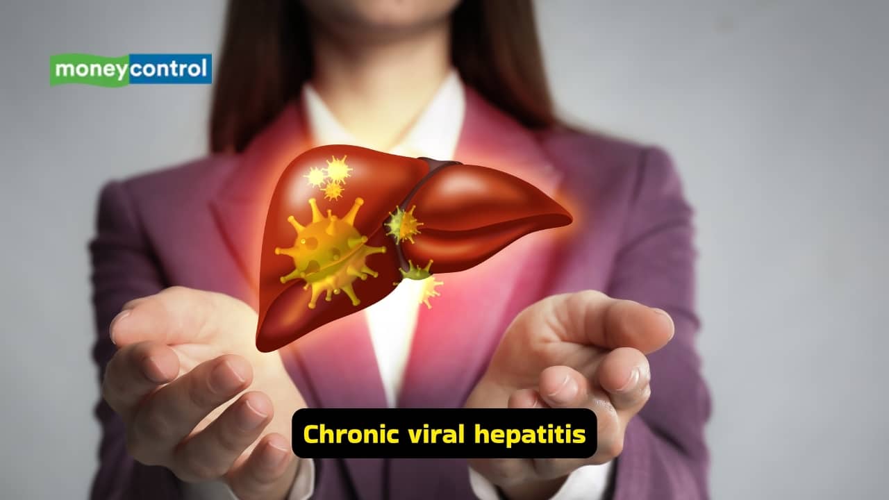 Ascites: Causes, symptoms, and best treatment options (Image: Canva)