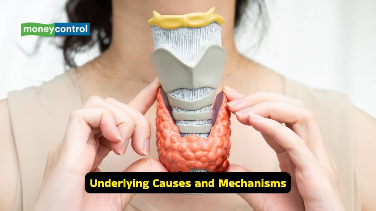 Osteoporosis Causes, symptoms, and prevention tips for stronger bones (Image: Canva)