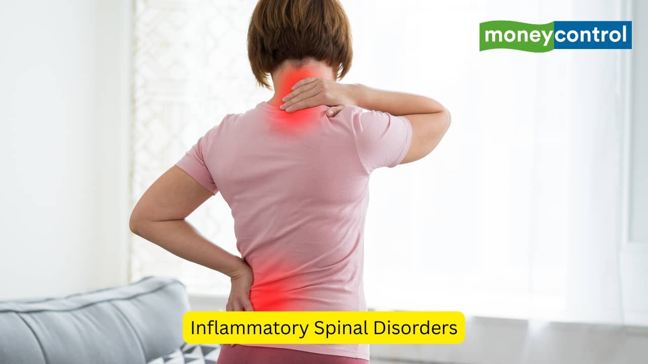 Inflammatory Spinal Disorders Inflammatory spondyloarthropathies are a group of diseases that lead to inflammation of the parts where the ligaments or joint capsules connect to the bone. The pain produced in such conditions worsens at rest, but the person feels relieved on physical exercise. (Image: Canva)
