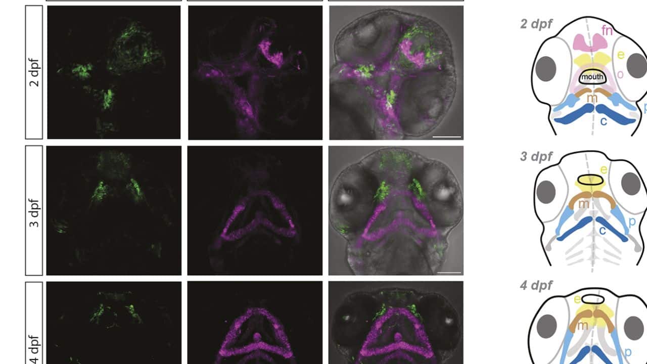 Neanderthal DNA may reveal secrets behind human facial development, scientists find