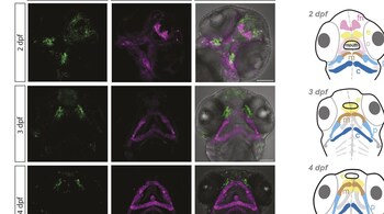 Neanderthal DNA May Reveal Secrets Behind Human Facial Development, Scientists Find (Image: Institute of Genetics and Cancer at the University of Edinburgh, UK/ journal Development)
