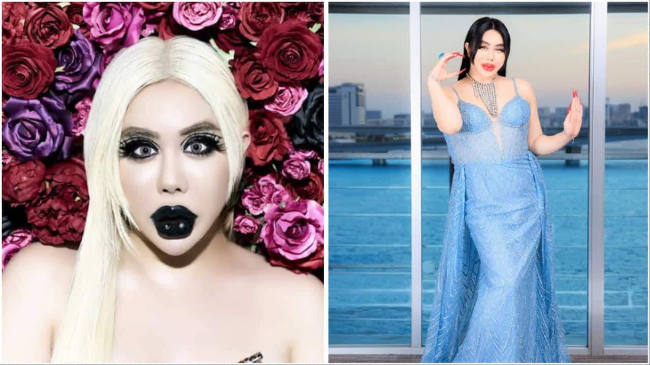 Man gets Rs 5.7 crore plastic surgery after being bullied: 'If I become world’s most beautiful...'
