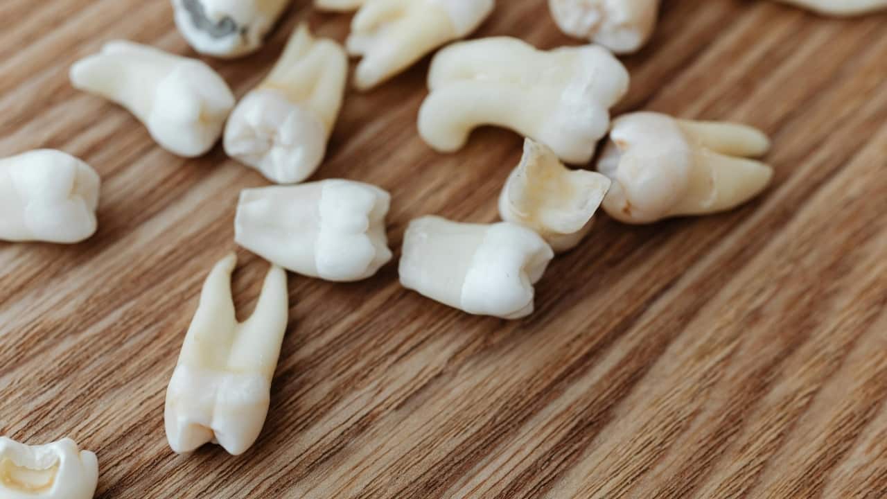 Dentist reveals how missing teeth can affect your digestion, speech, even confidence