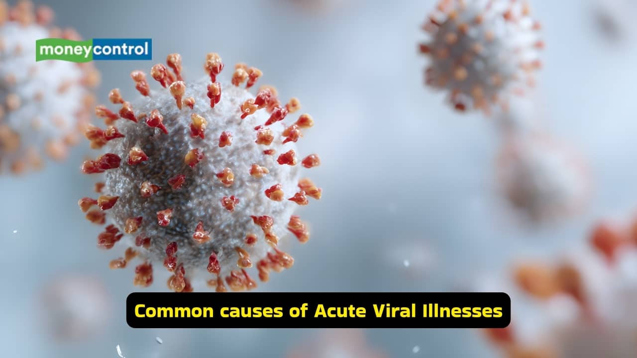<strong>Common causes of Acute Viral Illnesses</strong><br />Common agents that result in a viral infection include the influenza virus, rhinovirus and measles virus. Others like rotavirus and dengue virus may also cause similar symptoms. The mode of transmission of these organisms may either be via respiratory droplets or through the feco-oral route.
