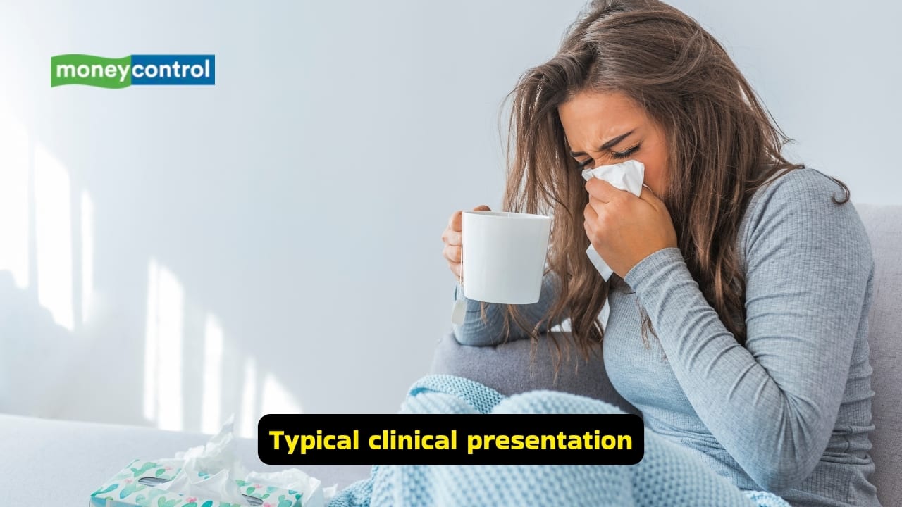 <strong>Typical clinical presentation</strong><br />Common clinical features of acute viral illness include fever, sore throat and a runny nose. The affected person may also experience cough, and if the virus has infected the gastrointestinal system, there may be diarrhoea, along with nausea and vomiting. Persistent body ache is quite common in such conditions.