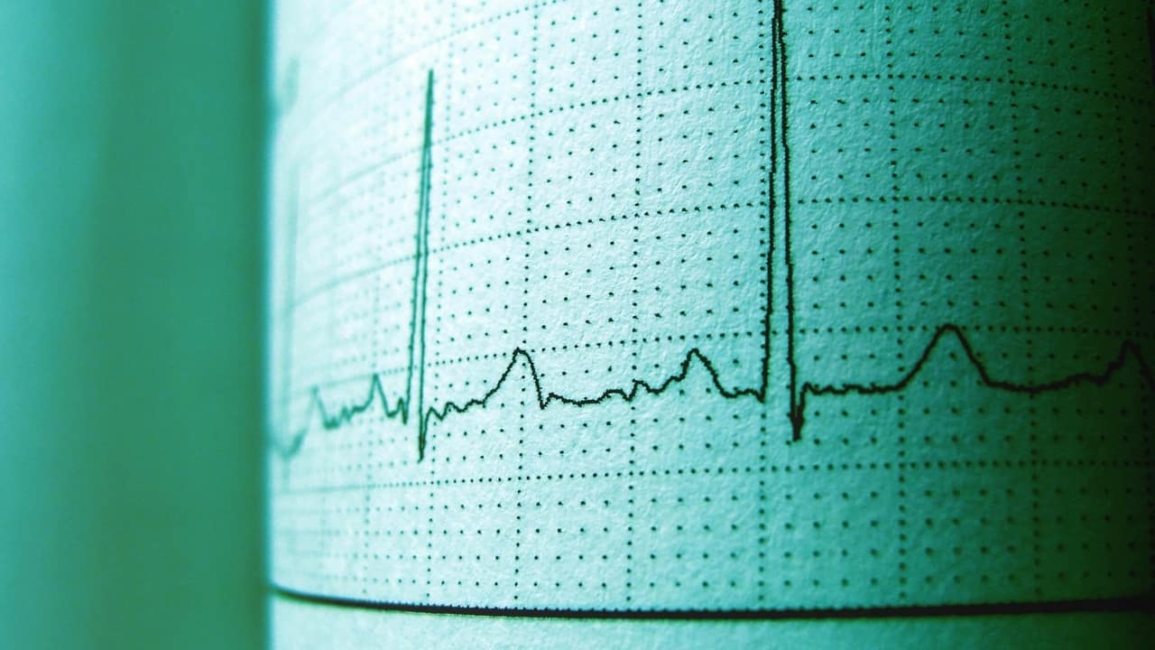Unexplained chest pain in women? Cardiologist explains why it could be SCAD and not a blocked artery