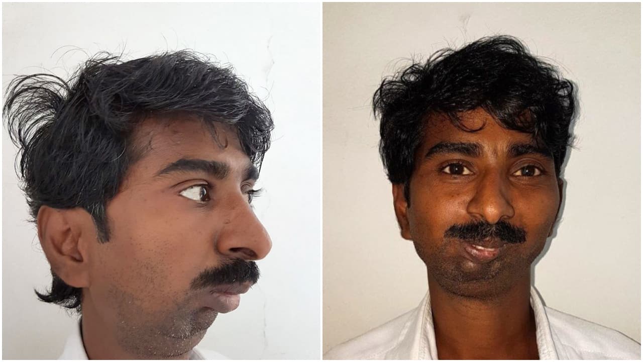 Real story behind viral pic of Pune man being used in racist posts against Indians. Who is Rajendra Panchal?