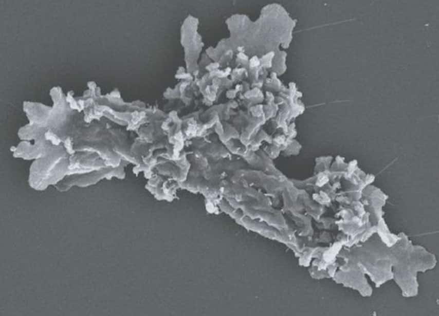 This newly discovered 'Fire Amoeba' survives extreme heat limits