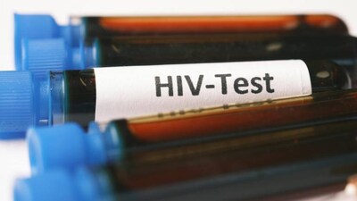 Delhi man in critical condition after following AI advice on preventive HIV drugs