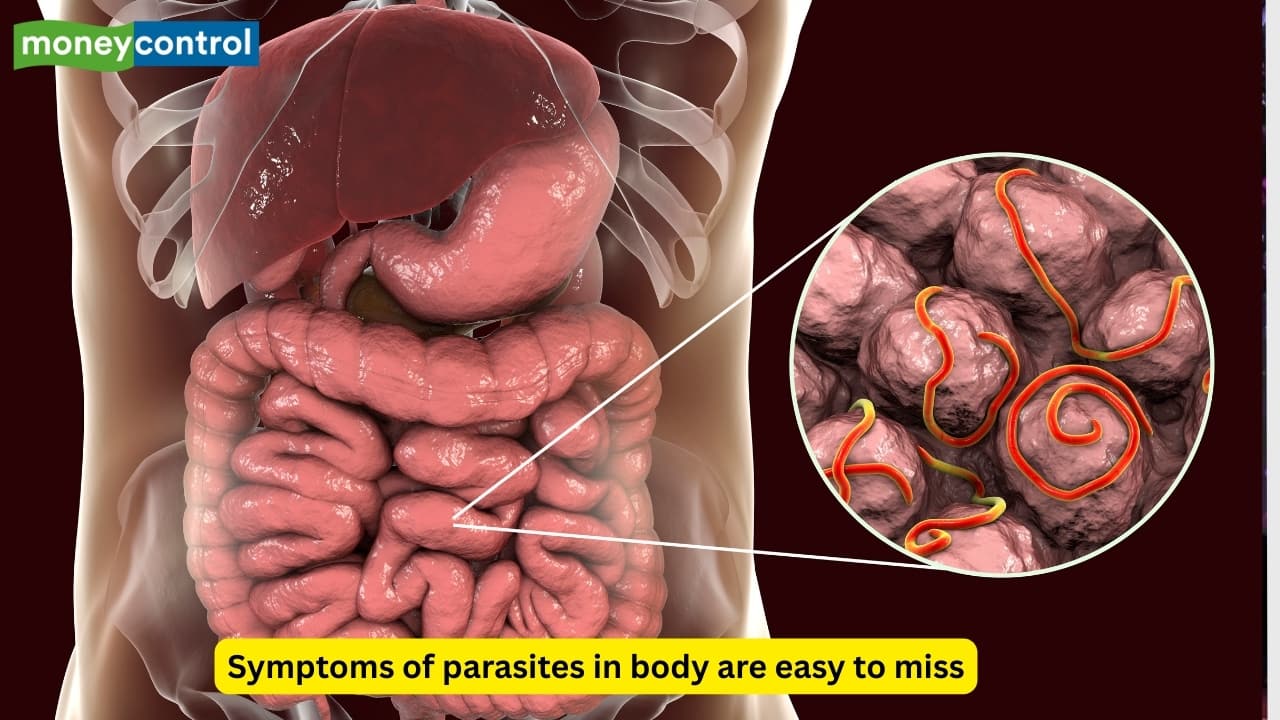 6 warning signs that you have parasite in your body, extreme desire for junk food and sugar is one of them