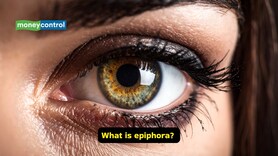 Causes, symptoms and treatment tips for epiphora: When tears won’t stop