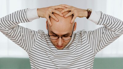 How to stop hair loss and male baldness: The study says that Clascoterone, when applied locally, can significantly reduce the hormonal activity — particularly dihydrotestosterone (DHT) — that shrinks hair follicles in men with androgenetic alopecia (Image: Pexels)