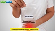 <strong>Mechanism of Key Etiologies</strong><br />The presence of gallstones causes an obstruction in the common duct, which leads to back flow of the enzymes. Excess alcohol may increase the viscosity of pancreatic secretions, and thus directly triggers cellular injury. Other causes like raised levels of calcium and triglycerides may also be etiological factors. (Picture Credit: Canva)