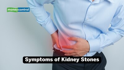 Symptoms of kidney stones: If you are feeling pain on one side of your back or your lower abdomen, it is possible that the stone is starting to move down inside the kidney (Image: Canva)
