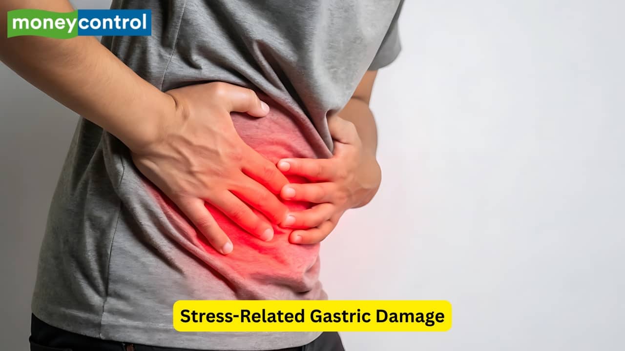 Stress-Related Gastric Damage Stress-related gastritis has been found to be caused by physiological stress, like burns and sepsis, along with a history of a major surgery. If the blood flow to the mucosa of the stomach is affected, erosive injury can develop. In severe cases, occult bleeding may be seen. (Image: Canva) Stress-Related Gastric Damage Stress-related gastritis has been found to be caused by physiological stress, like burns and sepsis, along with a history of a major surgery. If the blood flow to the mucosa of the stomach is affected, erosive injury can develop. In severe cases, occult bleeding may be seen. (Image: Canva)