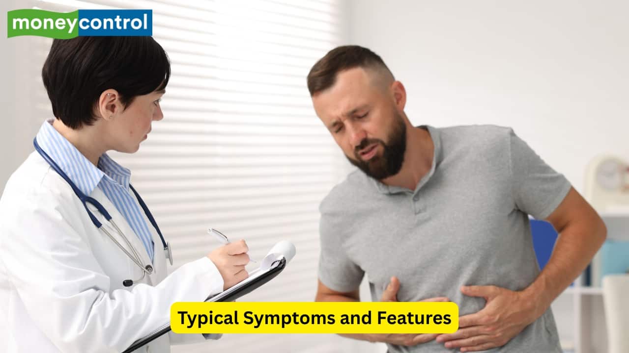 Typical Symptoms and Features While some may not have any symptoms, others may experience pain in the epigastric area, along with burning and fullness. Other features include nausea and vomiting. Some may even experience hematemesis or melena (blackish stools). Those with chronic gastritis experience fatigue because of anaemia as well. (Image: Canva) Typical Symptoms and Features While some may not have any symptoms, others may experience pain in the epigastric area, along with burning and fullness. Other features include nausea and vomiting. Some may even experience hematemesis or melena (blackish stools). Those with chronic gastritis experience fatigue because of anaemia as well. (Image: Canva)