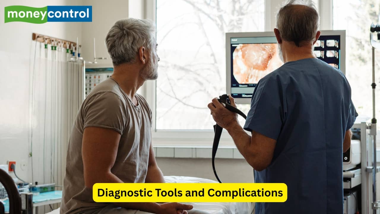 Diagnostic Tools and Complications The gold standard for the diagnosis of gastritis is endoscopy, which may show erythema and erosions as well. A biopsy can confirm the histological type. If left untreated, gastritis can cause peptic ulcers and mucosal atrophy. Autoimmune gastritis can lead to pernicious anaemia. (Image: Canva) Diagnostic Tools and Complications The gold standard for the diagnosis of gastritis is endoscopy, which may show erythema and erosions as well. A biopsy can confirm the histological type. If left untreated, gastritis can cause peptic ulcers and mucosal atrophy. Autoimmune gastritis can lead to pernicious anaemia. (Image: Canva)