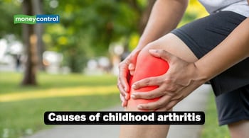 Causes of childhood arthritis Image: Canva)