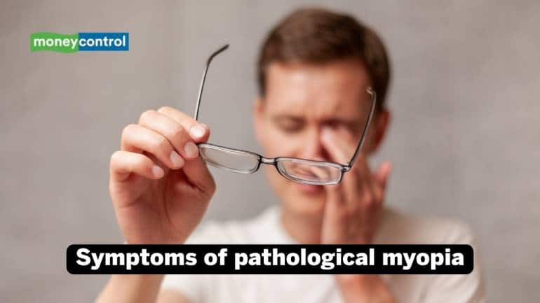 Symptoms of myopia (Images: Canva) Symptoms of myopia (Images: Canva)