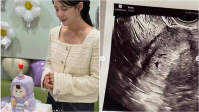 She also shared the news on Instagram with a cute photo dump, including pictures of a cute baby cake and her sonography scan.

