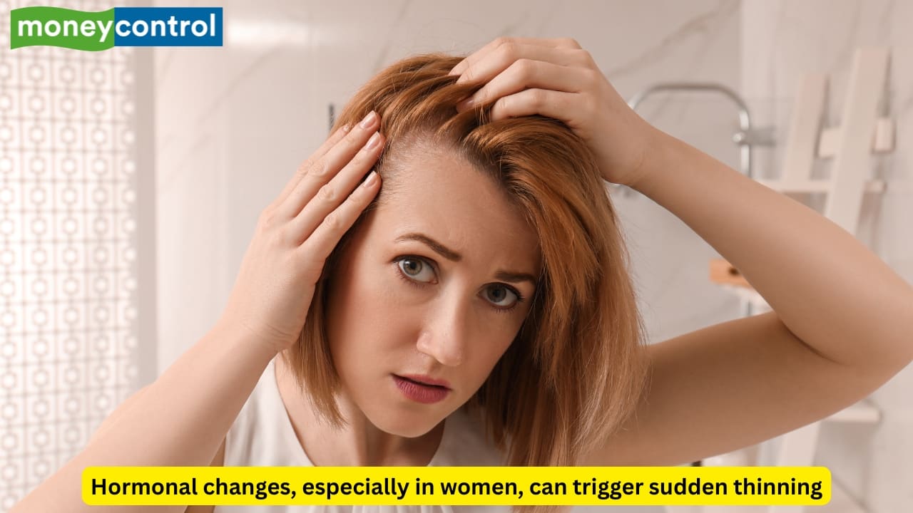 6 major causes behind hair thinning that you should not ignore