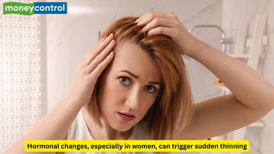 The quality of hair depends heavily on nutrients like iron, vitamin D, vitamin B12, protein, and other essential minerals. (Picture Credit: Canva)