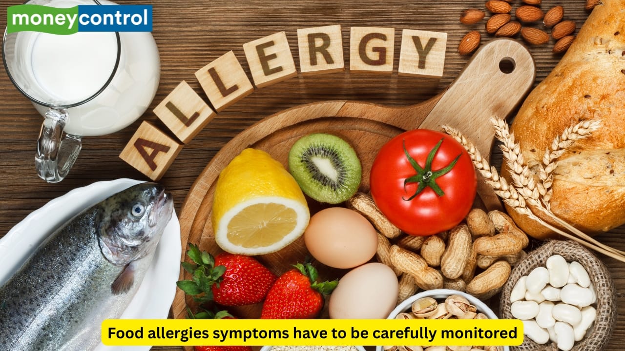 Senior doctor shares food allergy symptoms that you must not ignore