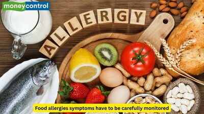 A doctor explains a food allergy is when the immune system mistakenly identifies an otherwise harmless food as something dangerous and responds to it. (Picture Credit: Canva)
